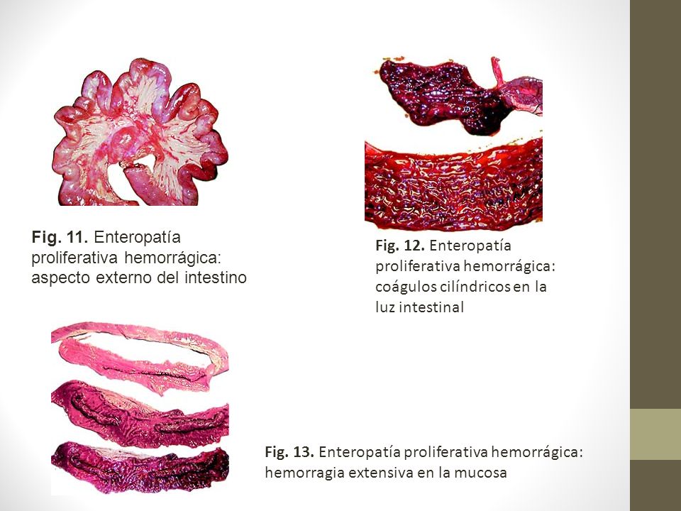 Fig. 11. Enteropatía proliferativa hemorrágica: aspecto externo del intestino