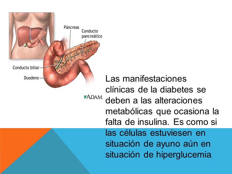 Las manifestaciones clínicas de la diabetes se deben a las alteraciones metabólicas que ocasiona la falta de insulina.