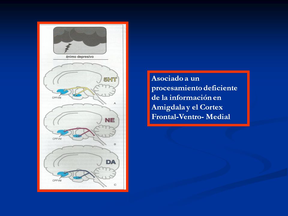 Asociado a un procesamiento deficiente de la información en Amigdala y el Cortex Frontal-Ventro- Medial
