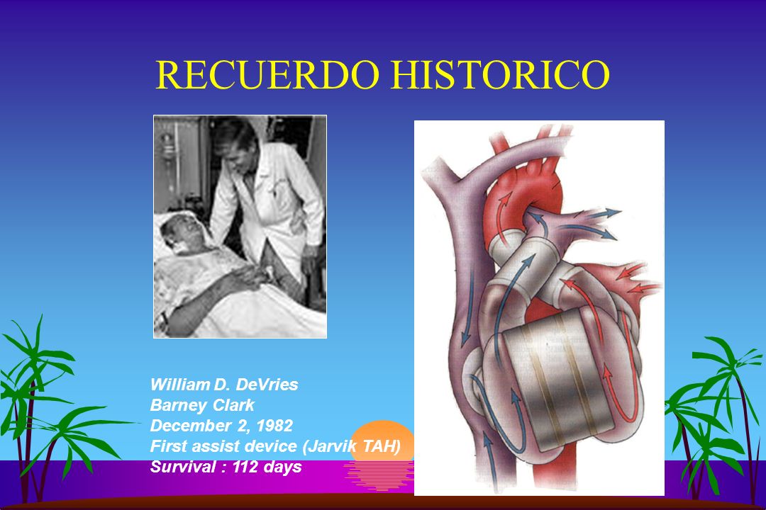 RECUERDO HISTORICO William D. DeVries Barney Clark December 2, 1982