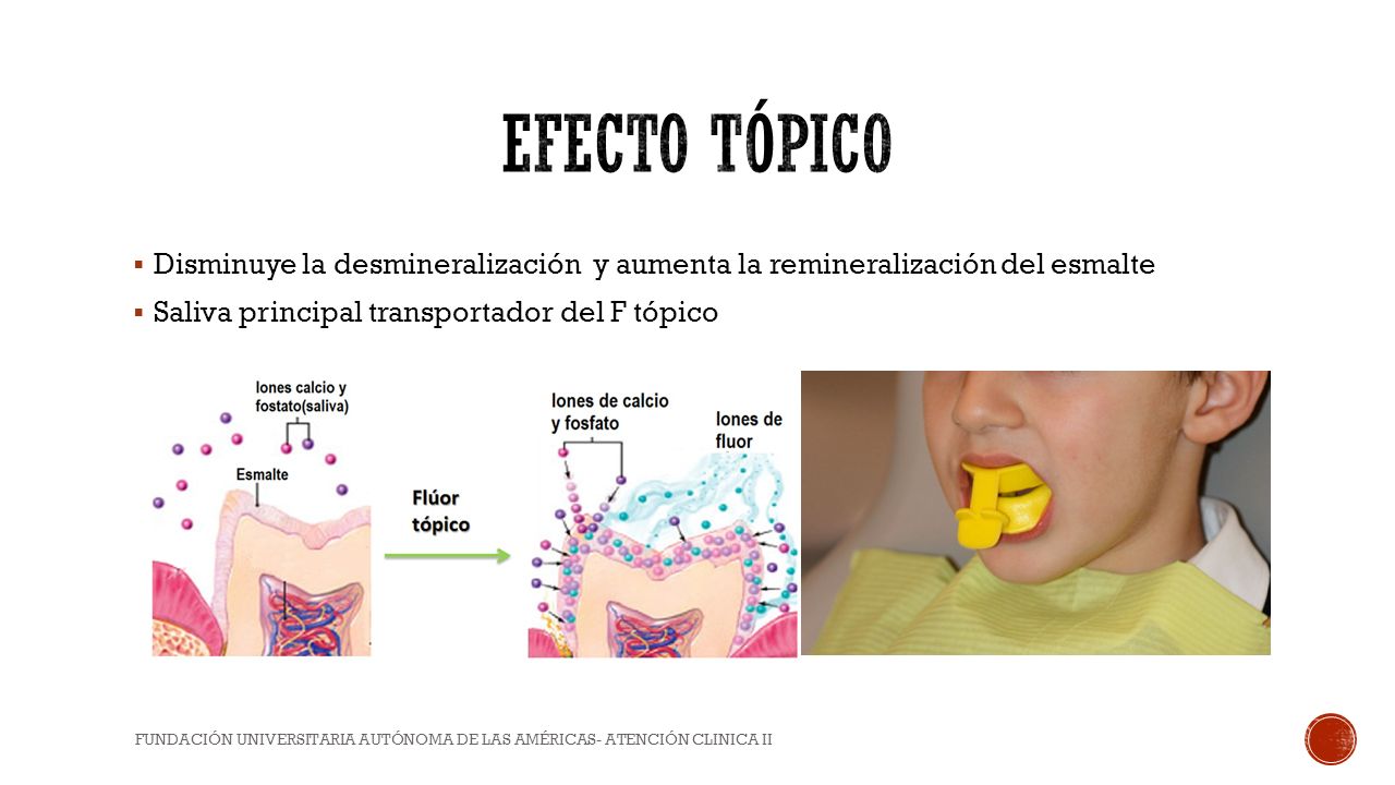 Efecto tópico Disminuye la desmineralización y aumenta la remineralización del esmalte. Saliva principal transportador del F tópico.