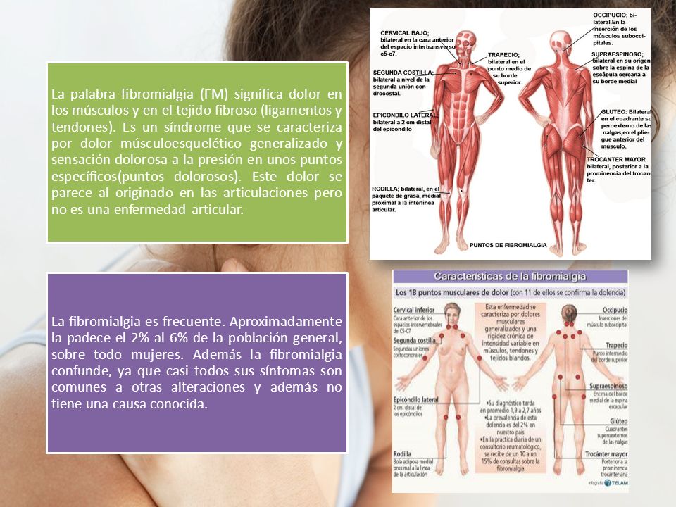 La palabra ﬁbromialgia (FM) signiﬁca dolor en los músculos y en el tejido ﬁbroso (ligamentos y tendones). Es un síndrome que se caracteriza por dolor músculoesquelético generalizado y sensación dolorosa a la presión en unos puntos especíﬁcos(puntos dolorosos). Este dolor se parece al originado en las articulaciones pero no es una enfermedad articular.