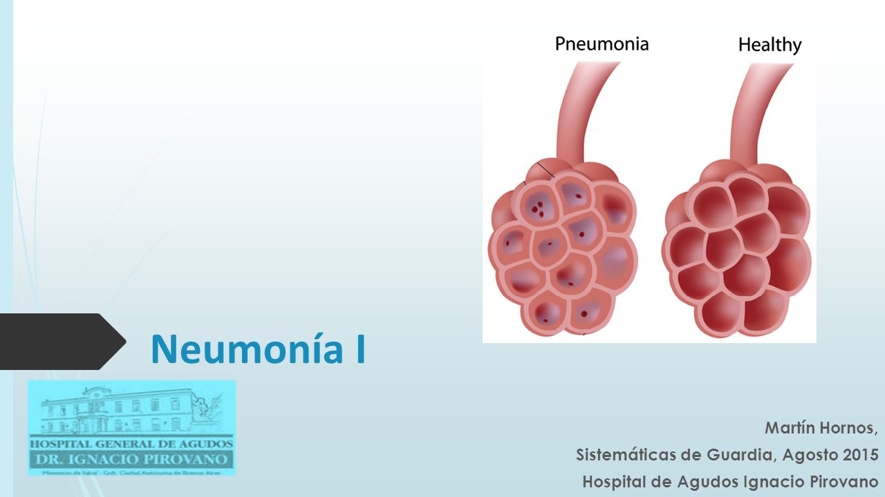 Neumonía I Martín Hornos, Sistemáticas de Guardia, Agosto 2015