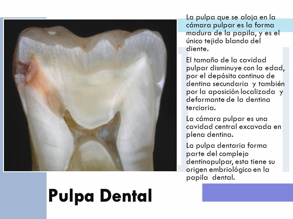 Pulpa Dental La pulpa que se aloja en la cámara pulpar es la forma madura de la papila, y es el único tejido blando del diente.