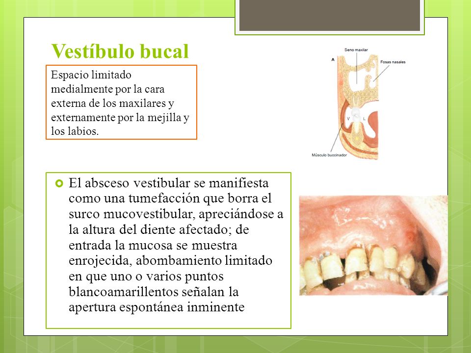 Vestíbulo bucal Espacio limitado medialmente por la cara externa de los maxilares y externamente por la mejilla y los labios.