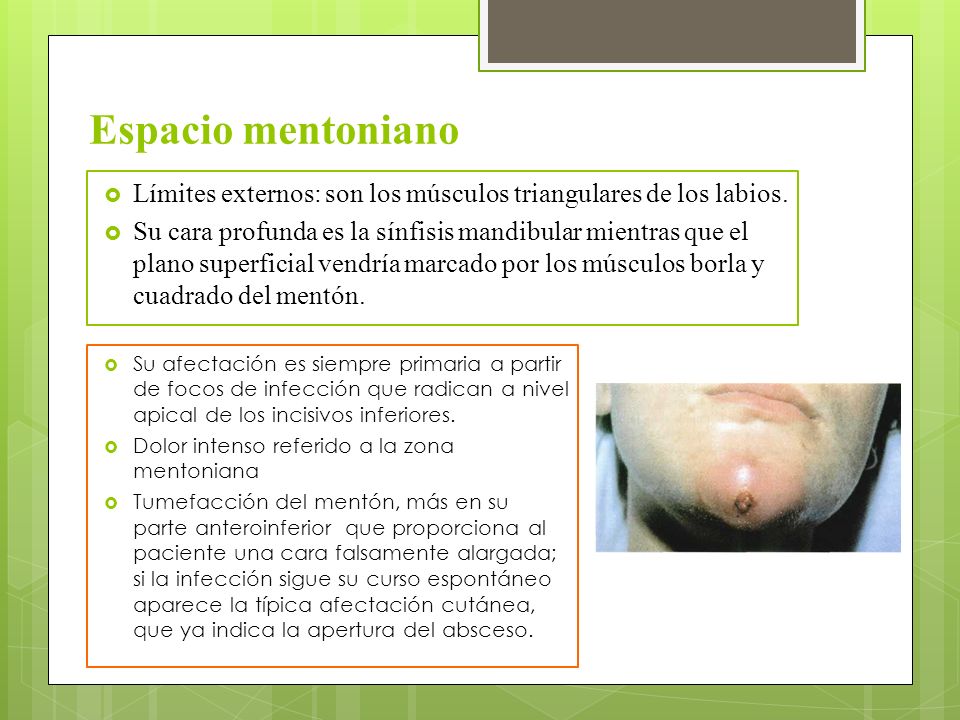 Espacio mentoniano Límites externos: son los músculos triangulares de los labios.