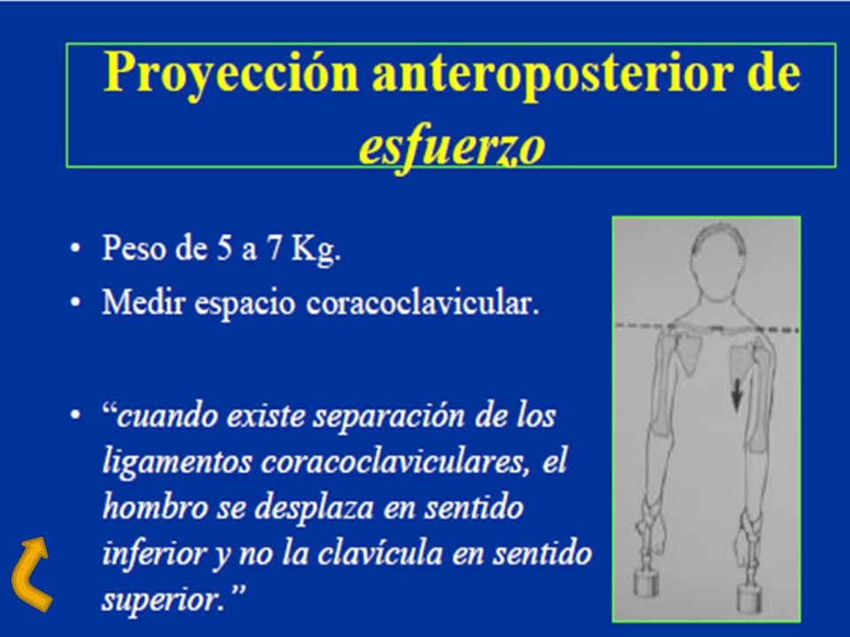 ARTICUALCION ACROMICLAVICULAR PROYECCION AP (METODO BILATERAL DE PEARSON) Posicion del paciente: se puede hacer en bipedaestacion o con el paciente sentado, el chasis tiene que ajustarse para que quede la articulacion acromioclavicular centrada en la placa.