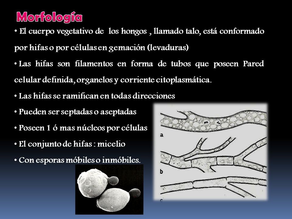 Morfología El cuerpo vegetativo de los hongos , llamado talo, está conformado por hifas o por células en gemación (levaduras)
