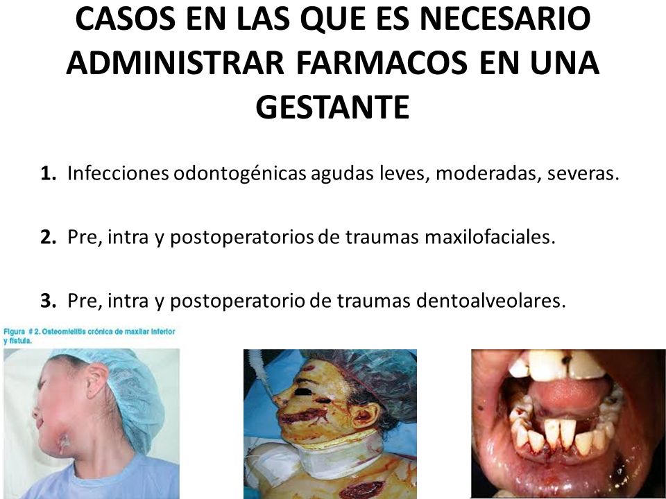 CASOS EN LAS QUE ES NECESARIO ADMINISTRAR FARMACOS EN UNA GESTANTE