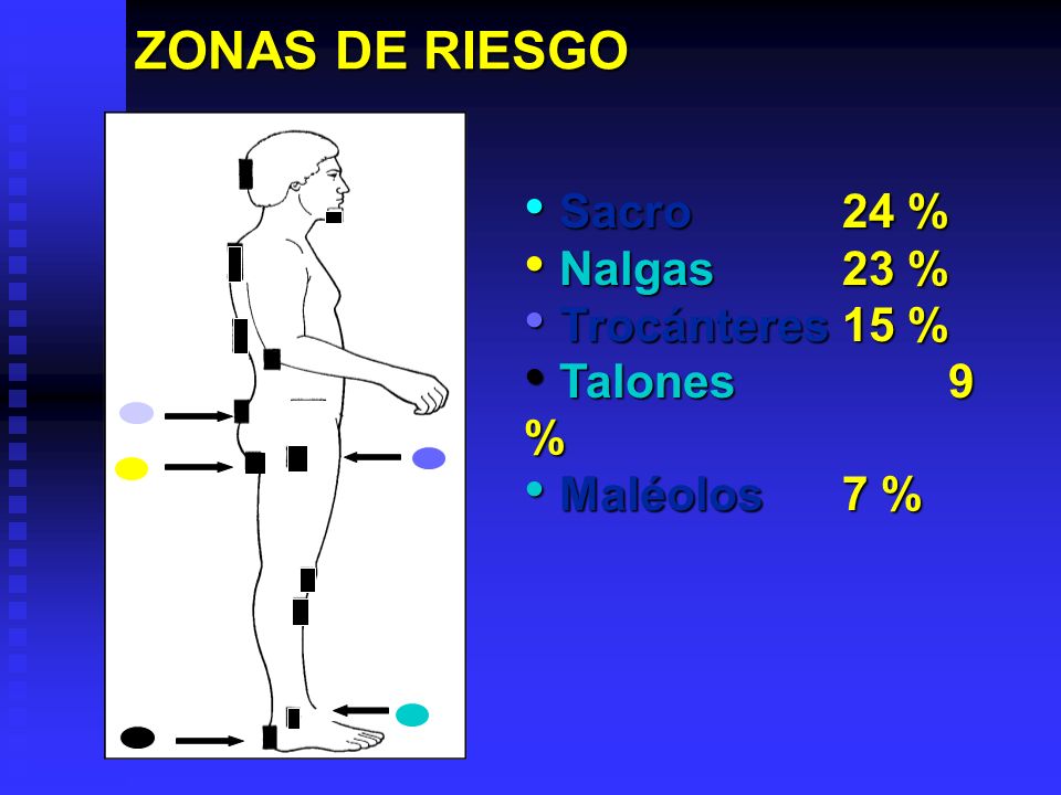 ZONAS DE RIESGO Sacro 24 % Nalgas 23 % Trocánteres 15 % Talones 9 %