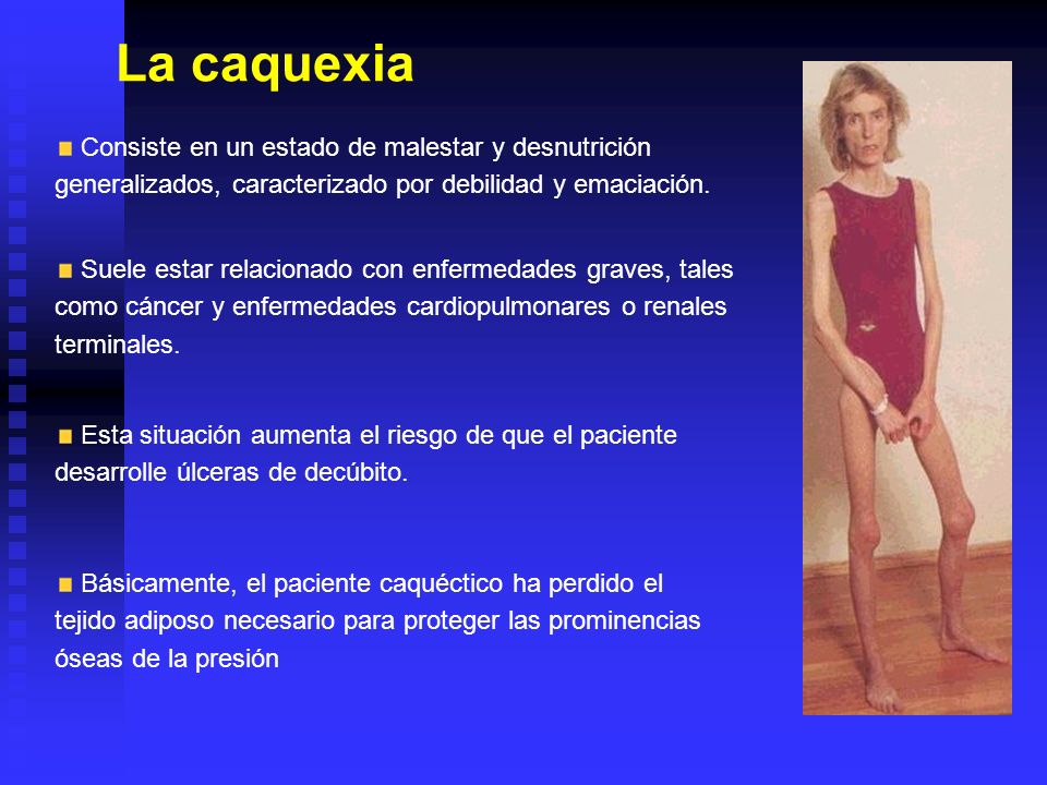 La caquexia Consiste en un estado de malestar y desnutrición generalizados, caracterizado por debilidad y emaciación.