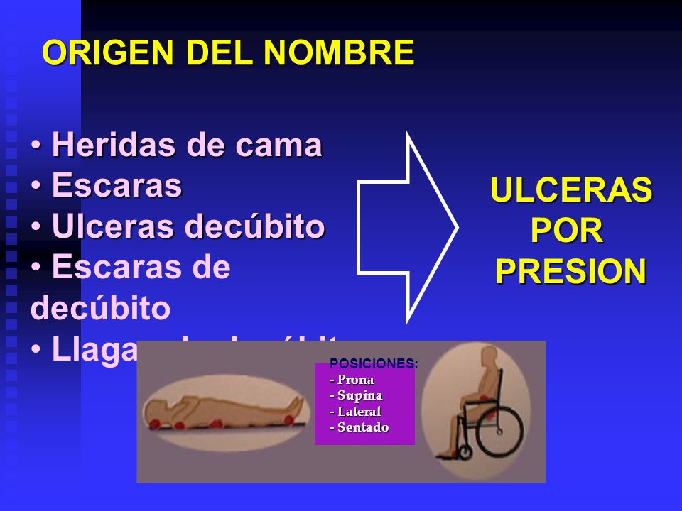 ORIGEN DEL NOMBRE Heridas de cama Escaras Ulceras decúbito ULCERAS