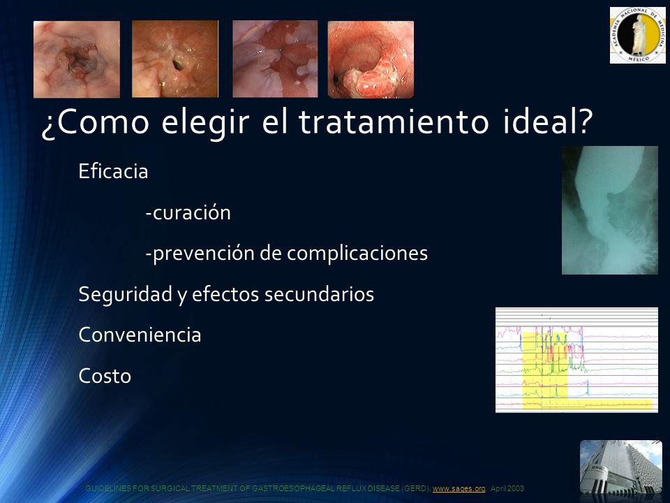¿Como elegir el tratamiento ideal