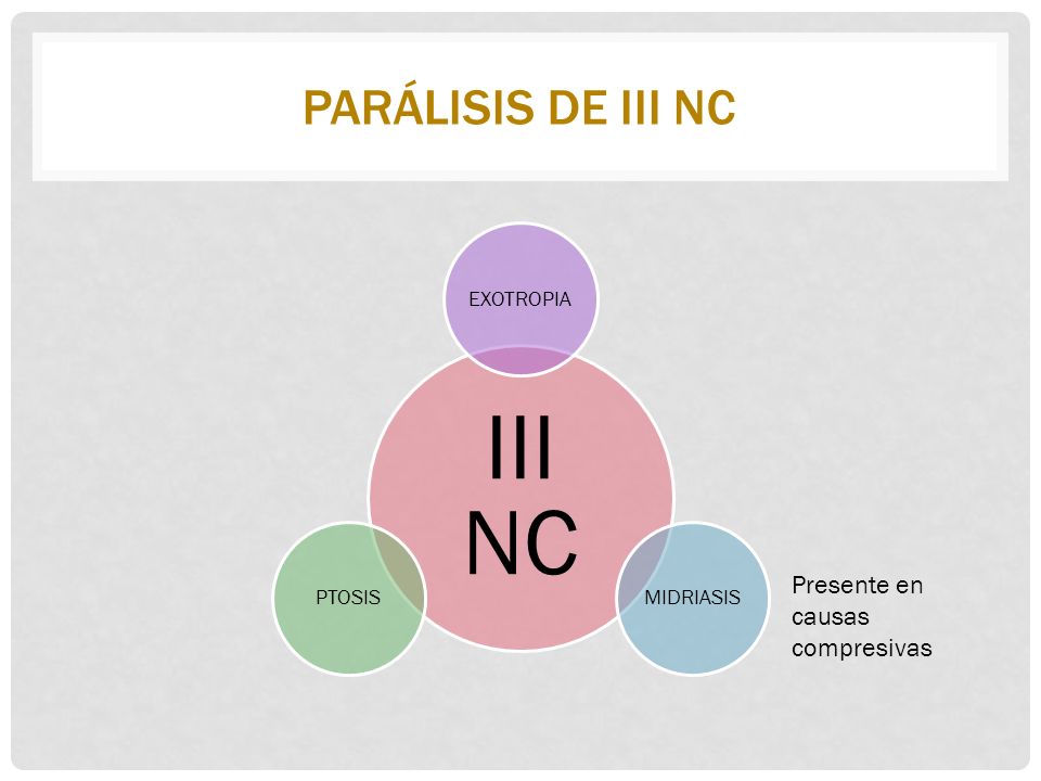 III NC Parálisis de III nc Presente en causas compresivas EXOTROPIA