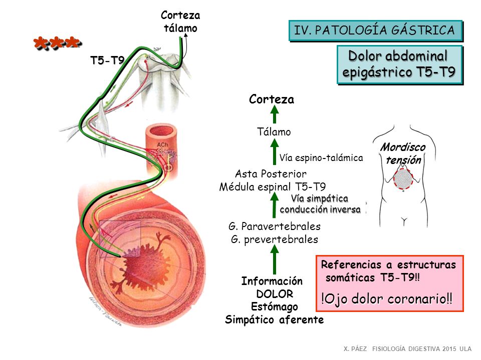 * ** Dolor abdominal epigástrico T5-T9 !Ojo dolor coronario!!