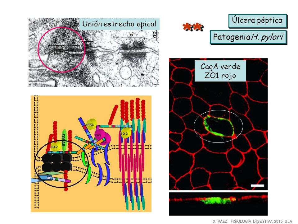 * * PatogeniaH. pylori Úlcera péptica Unión estrecha apical CagA verde