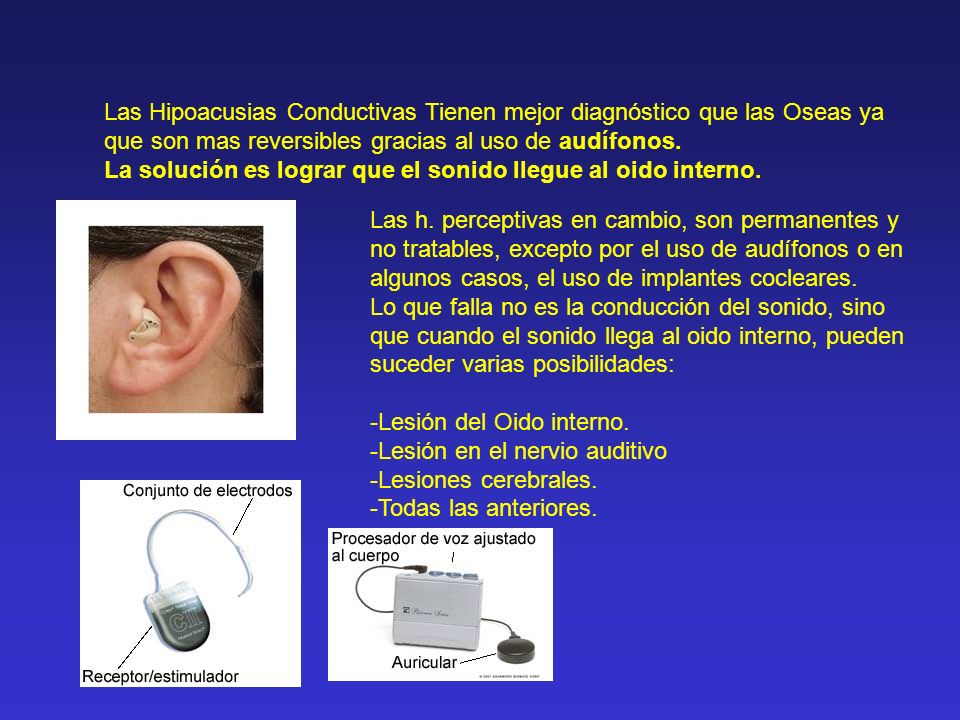 Las Hipoacusias Conductivas Tienen mejor diagnóstico que las Oseas ya que son mas reversibles gracias al uso de audífonos.