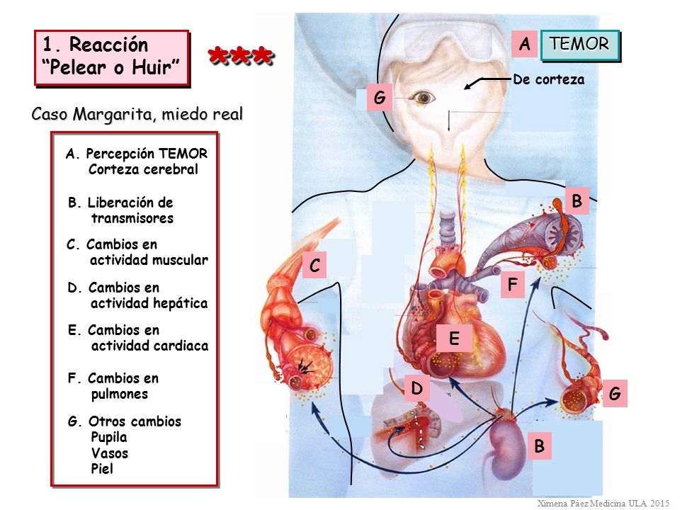 *** 1. Reacción Pelear o Huir A TEMOR G Caso Margarita, miedo real B