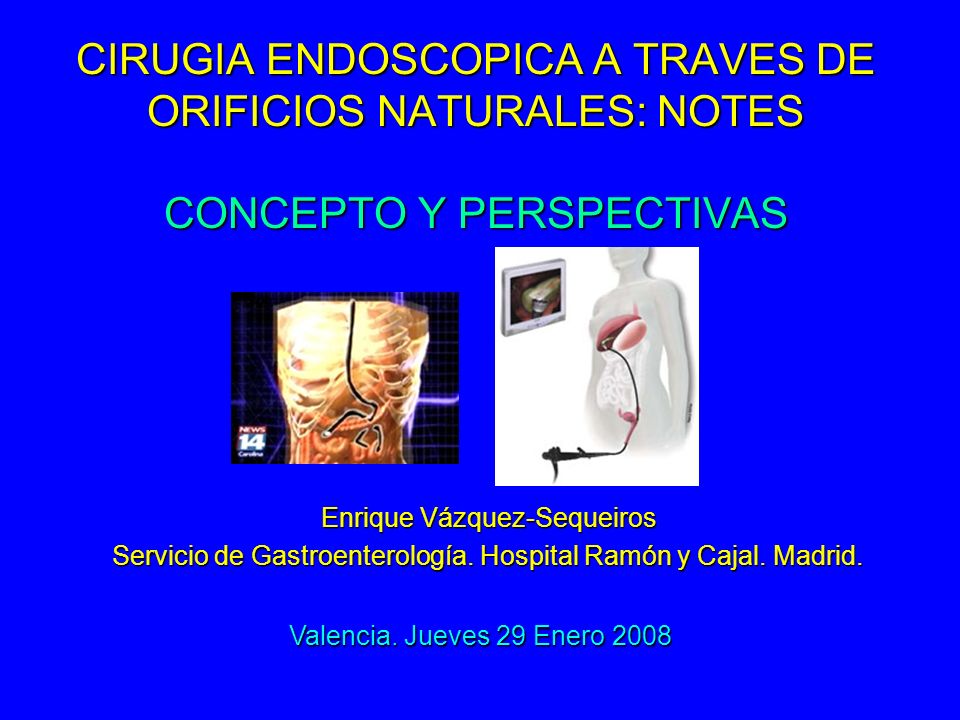 CIRUGIA ENDOSCOPICA A TRAVES DE ORIFICIOS NATURALES: NOTES CONCEPTO Y PERSPECTIVAS