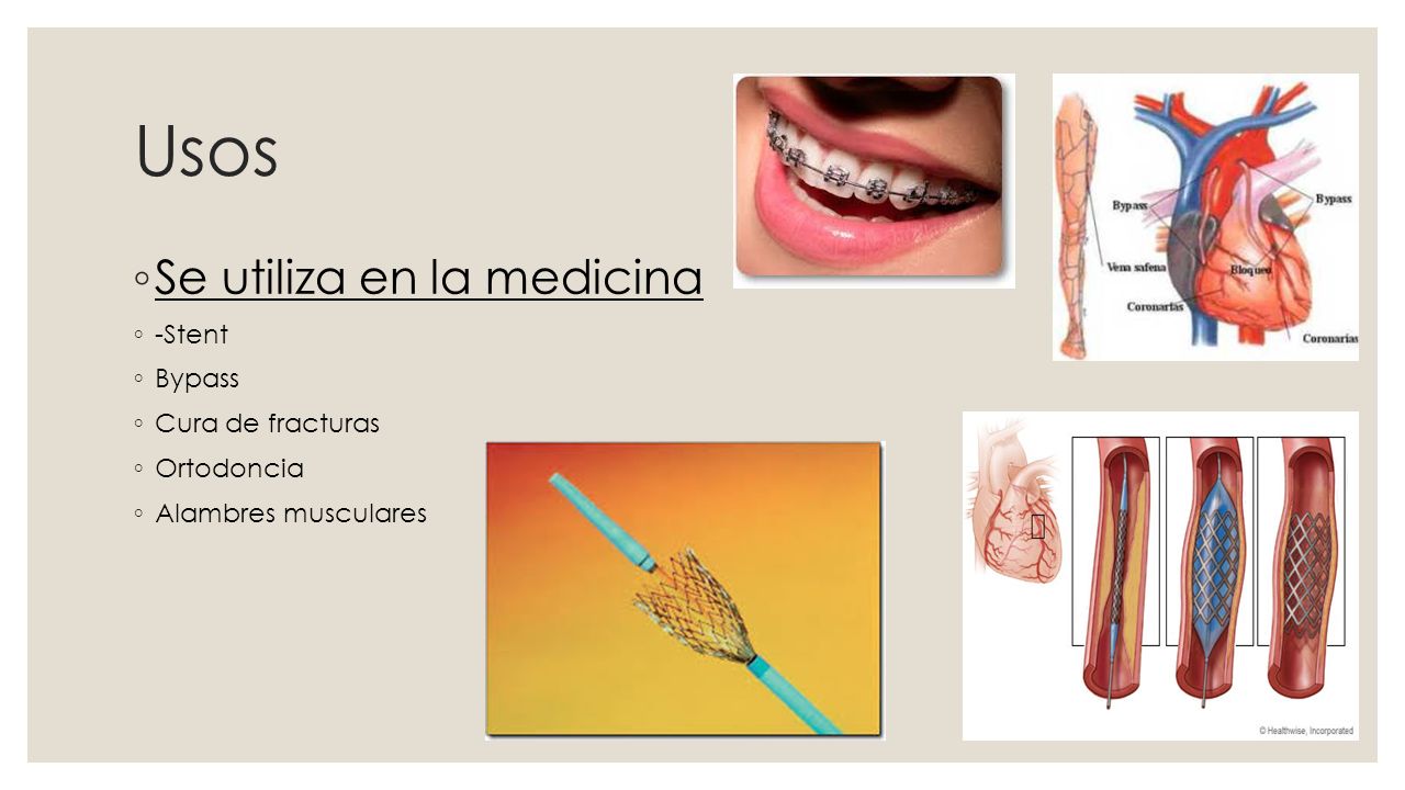 Usos Se utiliza en la medicina -Stent Bypass Cura de fracturas