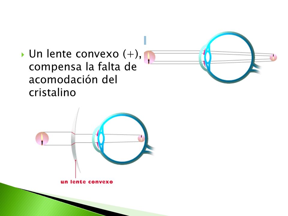 Un lente convexo (+), compensa la falta de acomodación del cristalino