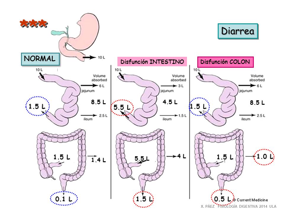 *** Diarrea NORMAL 1.5 L 5.5 L 1.5 L 1.5 L 1.5 L 1.0 L 0.1 L 1.5 L