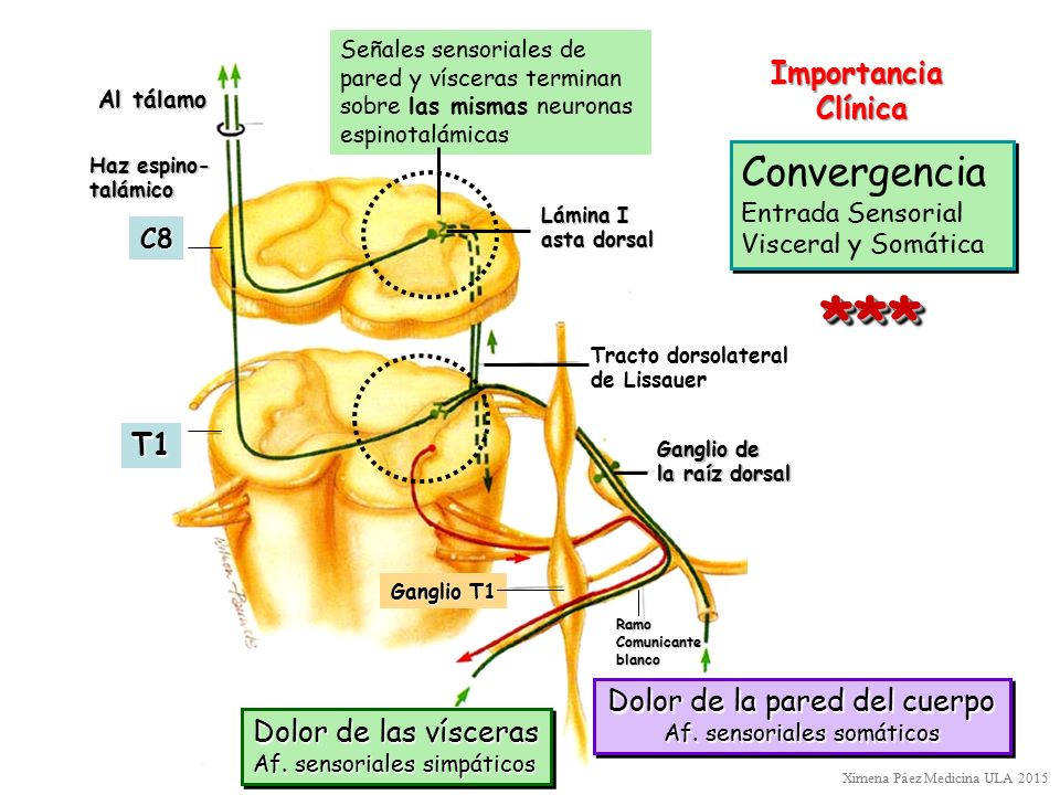 *** Convergencia Importancia Clínica T1 Dolor de la pared del cuerpo