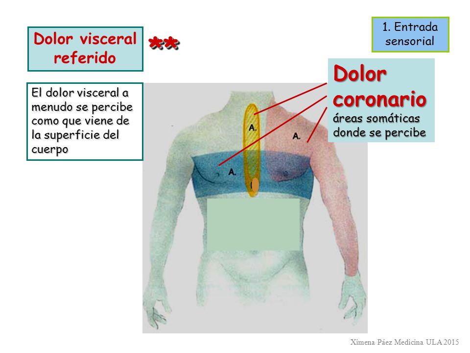** Dolor coronario Dolor visceral referido 1. Entrada sensorial