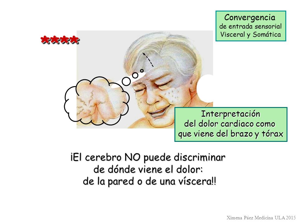 **** ¡El cerebro NO puede discriminar de dónde viene el dolor: