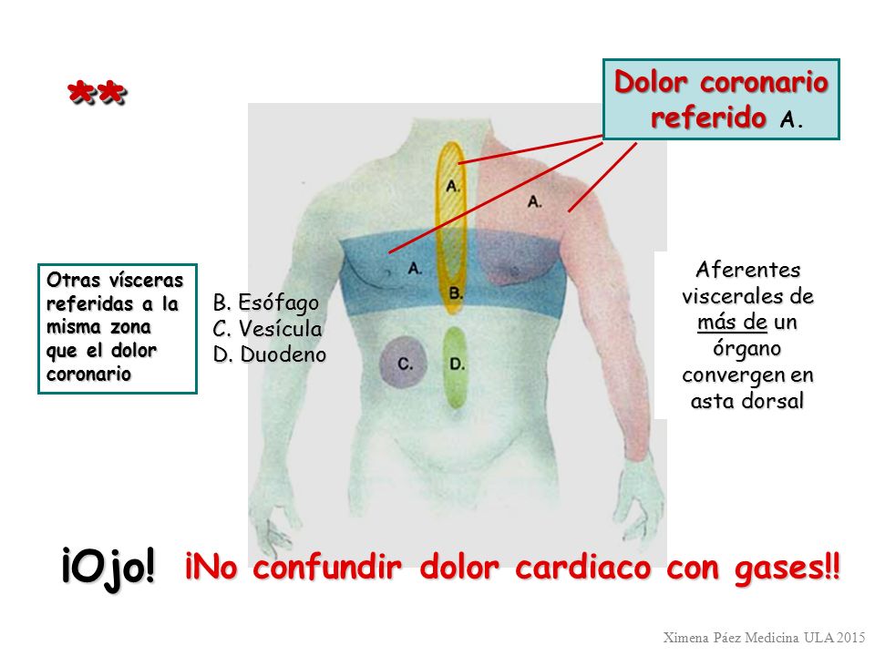 * * ¡Ojo! ¡No confundir dolor cardiaco con gases!! Dolor coronario