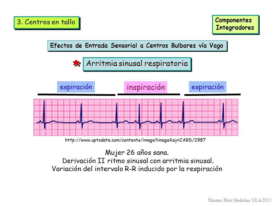 * Arritmia sinusal respiratoria inspiración 3. Centros en tallo