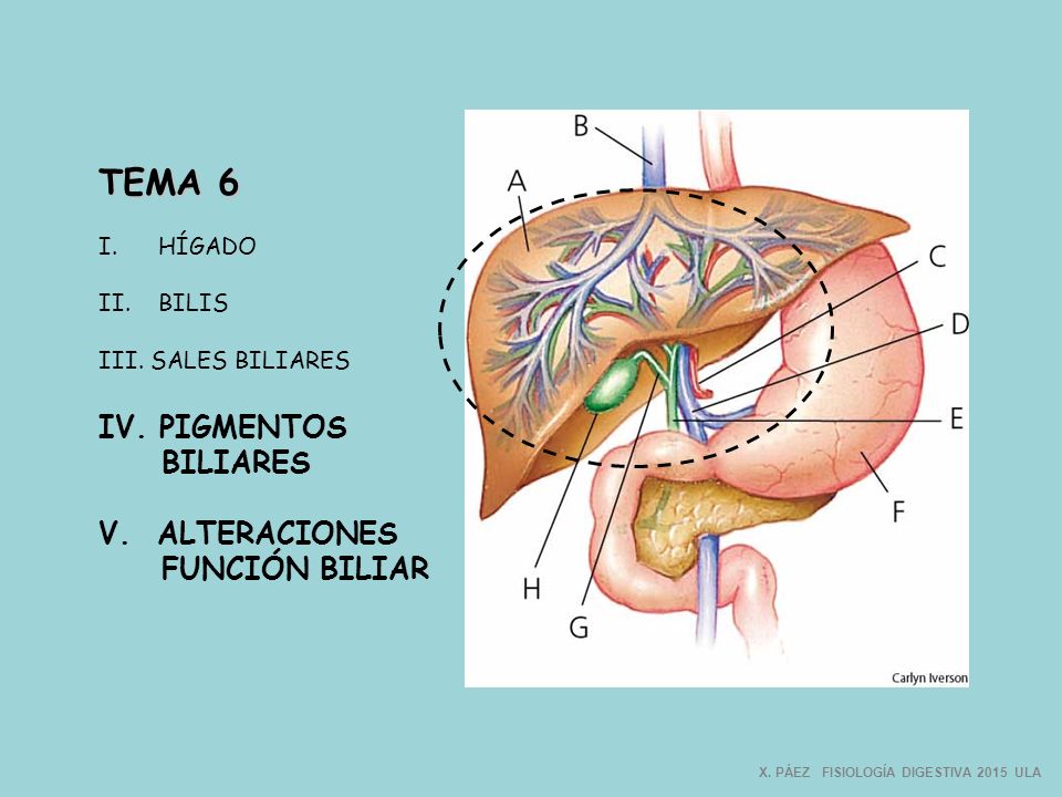 TEMA 6 IV. PIGMENTOS BILIARES V. ALTERACIONES FUNCIÓN BILIAR HÍGADO