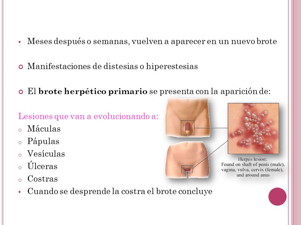 Meses después o semanas, vuelven a aparecer en un nuevo brote