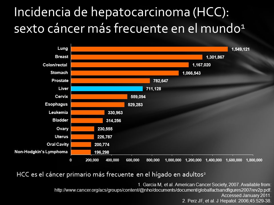 Incidencia de hepatocarcinoma (HCC): sexto cáncer más frecuente en el mundo1