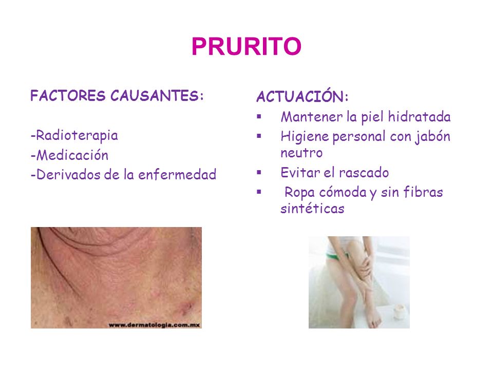 PRURITO FACTORES CAUSANTES: -Radioterapia -Medicación -Derivados de la enfermedad ACTUACIÓN: Mantener la piel hidratada.