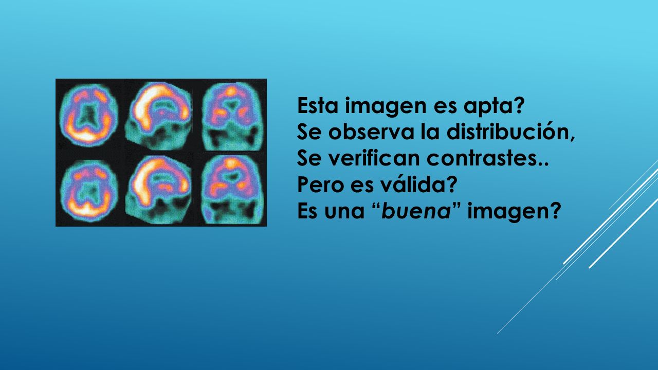 Esta imagen es apta. Se observa la distribución, Se verifican contrastes..