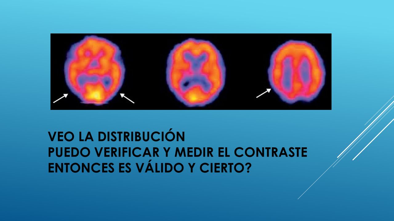 Veo la distribución puedo verificar y medir el contraste entonces es válido y cierto