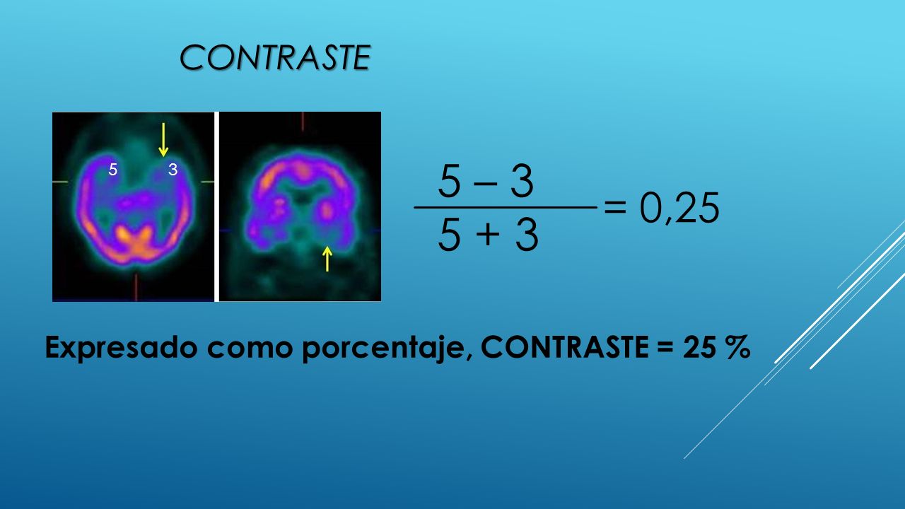 contraste 5 – = 0,25 Expresado como porcentaje, CONTRASTE = 25 %
