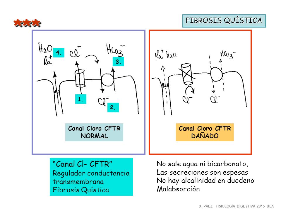 * ** Canal Cl- CFTR FIBROSIS QUÍSTICA No sale agua ni bicarbonato,
