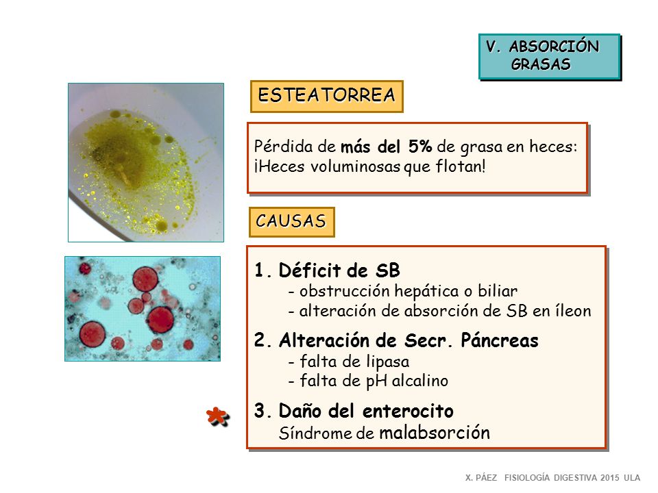 * ESTEATORREA Déficit de SB 2. Alteración de Secr. Páncreas
