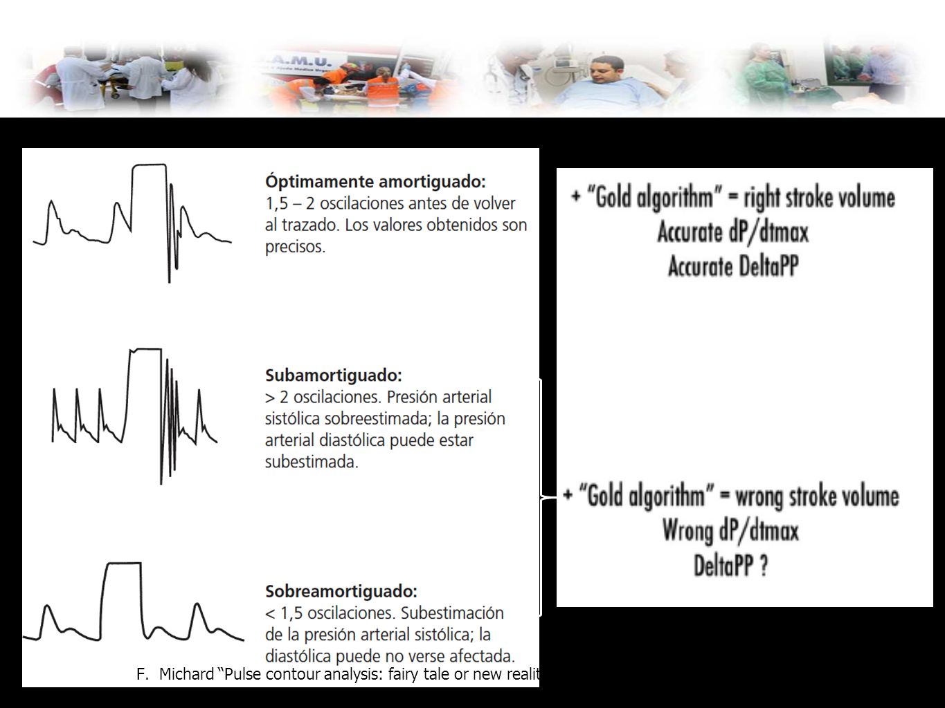 Monitorización PA F. Michard Pulse contour analysis: fairy tale or new reality , Crit Care Med.