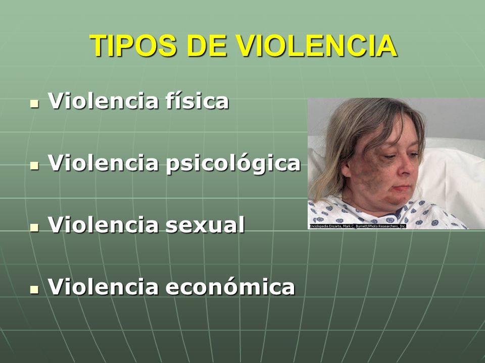 TIPOS DE VIOLENCIA Violencia física Violencia psicológica