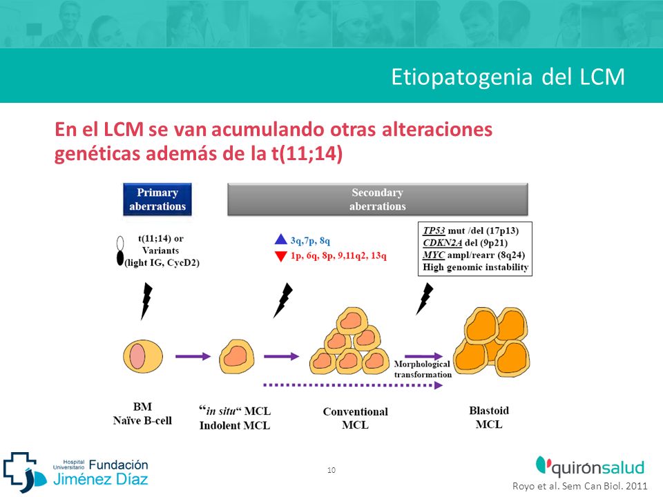 Etiopatogenia del LCM En el LCM se van acumulando otras alteraciones genéticas además de la t(11;14)