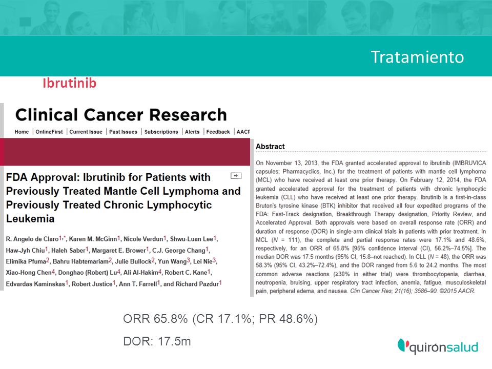 Tratamiento Ibrutinib ORR 65.8% (CR 17.1%; PR 48.6%) DOR: 17.5m