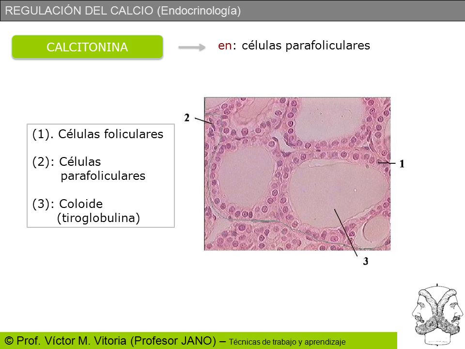 CALCITONINA en: células parafoliculares. (1). Células foliculares. (2): Células. parafoliculares.