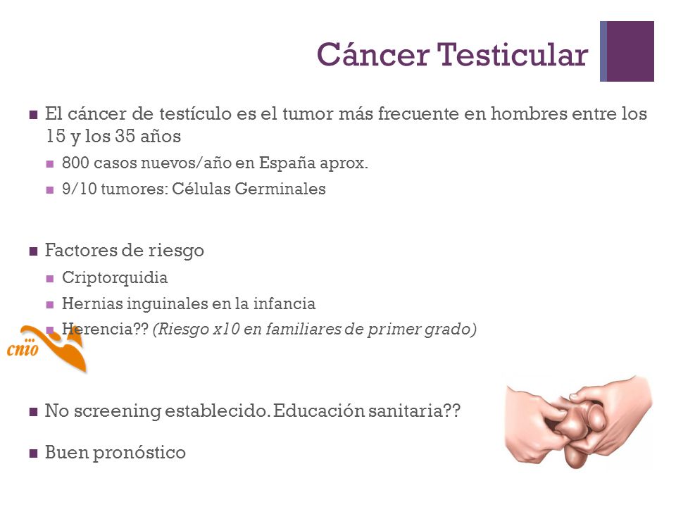 Cáncer Testicular El cáncer de testículo es el tumor más frecuente en hombres entre los 15 y los 35 años.