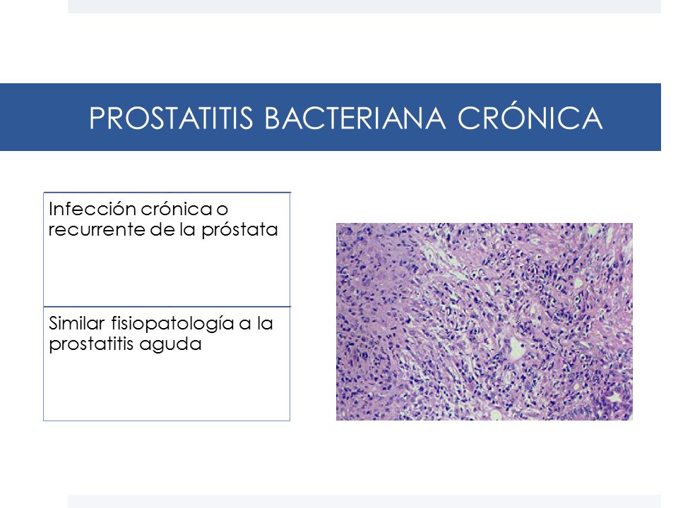 PROSTATITIS BACTERIANA CRÓNICA