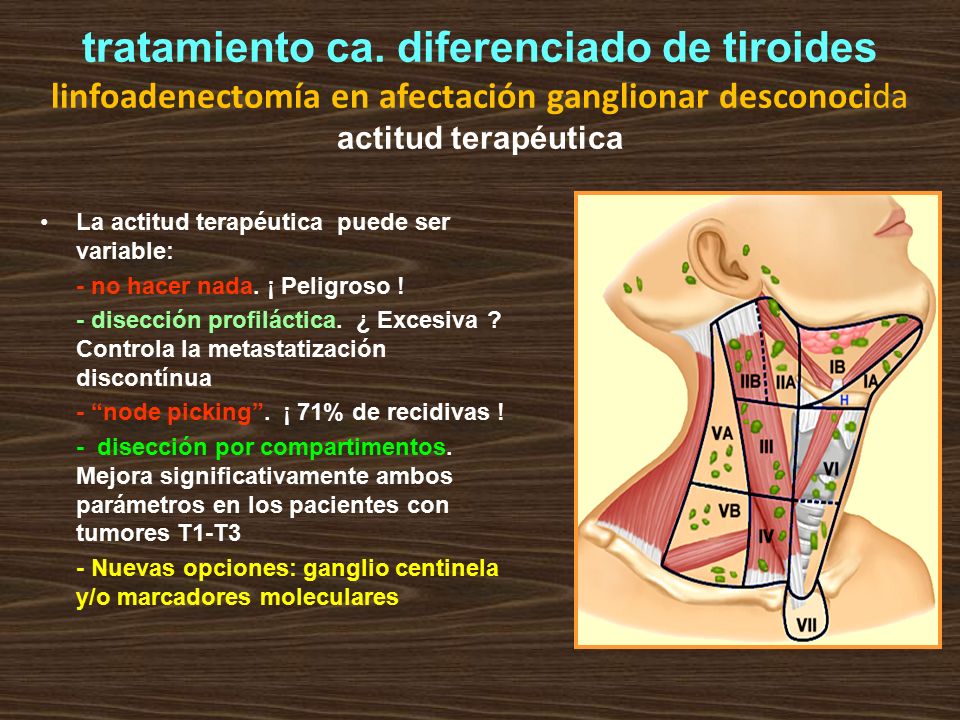 tratamiento ca. diferenciado de tiroides linfoadenectomía en afectación ganglionar desconocida actitud terapéutica