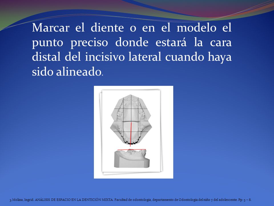 Marcar el diente o en el modelo el punto preciso donde estará la cara distal del incisivo lateral cuando haya sido alineado.