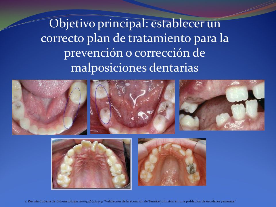 Objetivo principal: establecer un correcto plan de tratamiento para la prevención o corrección de malposiciones dentarias
